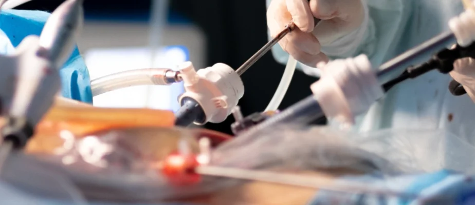 Feature Advanced Laparoscopic Procedures