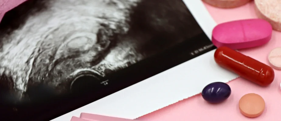 Feature Infertility