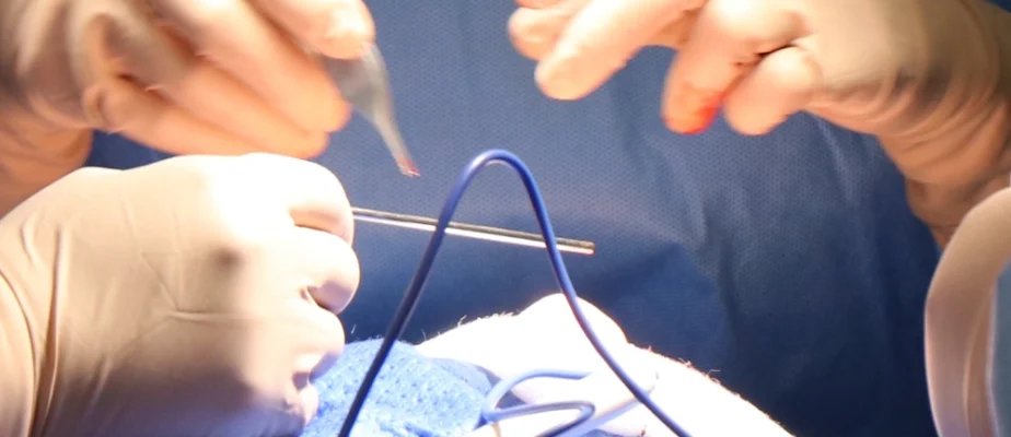 Feature Onco-Surgery