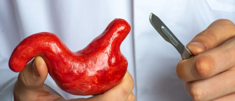 Feature Bariatric Surgery